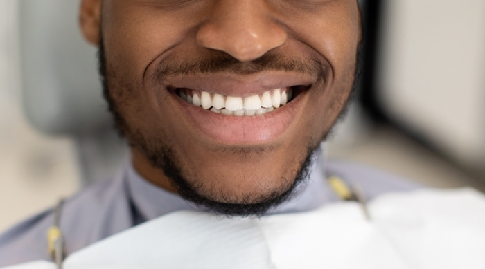 Smile Enhancements